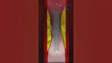 Heart Attack Treatment || HEART STENT ||  Angioplasty ||- PCI